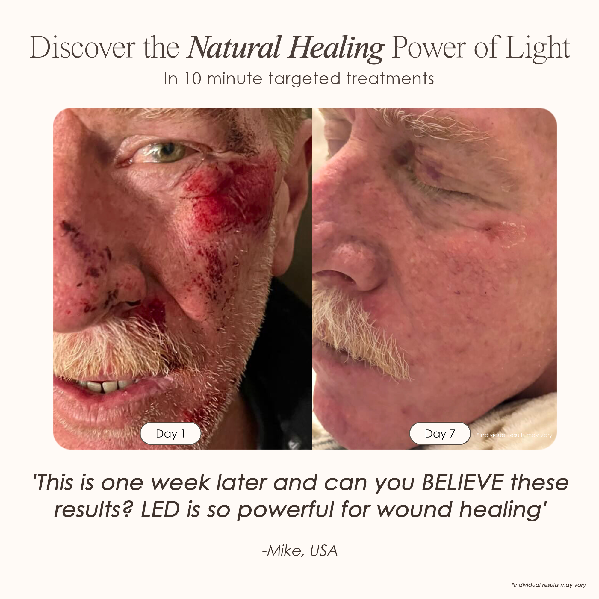 visible results after 7 days of using the LED light therapy 