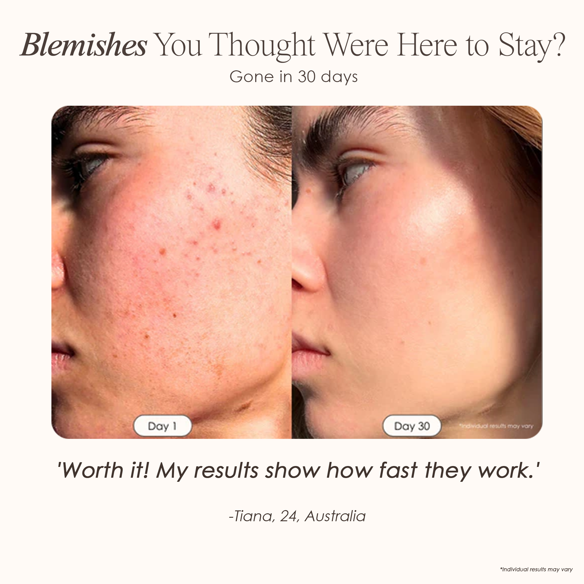 visible results after 30 days of using the LED light therapy 